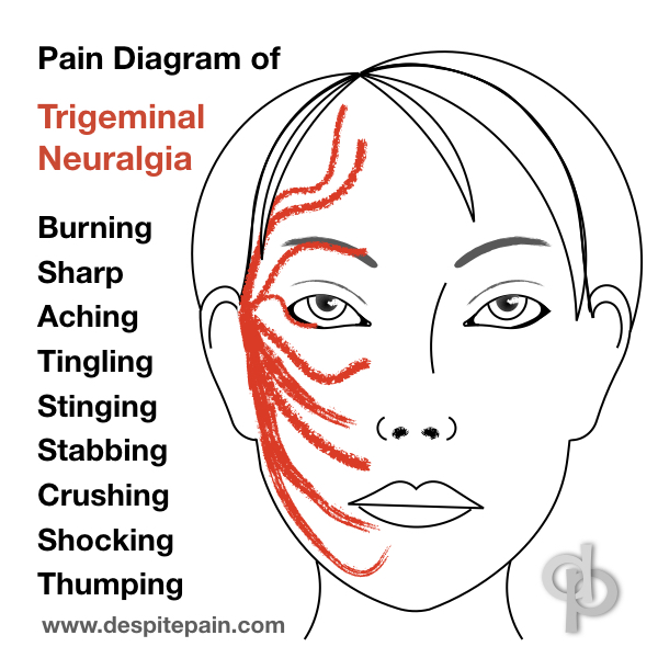 Pain diagram to describe to doctor where the pain is and how it feels. Picture explains face pain condition, trigeminal neuralgia